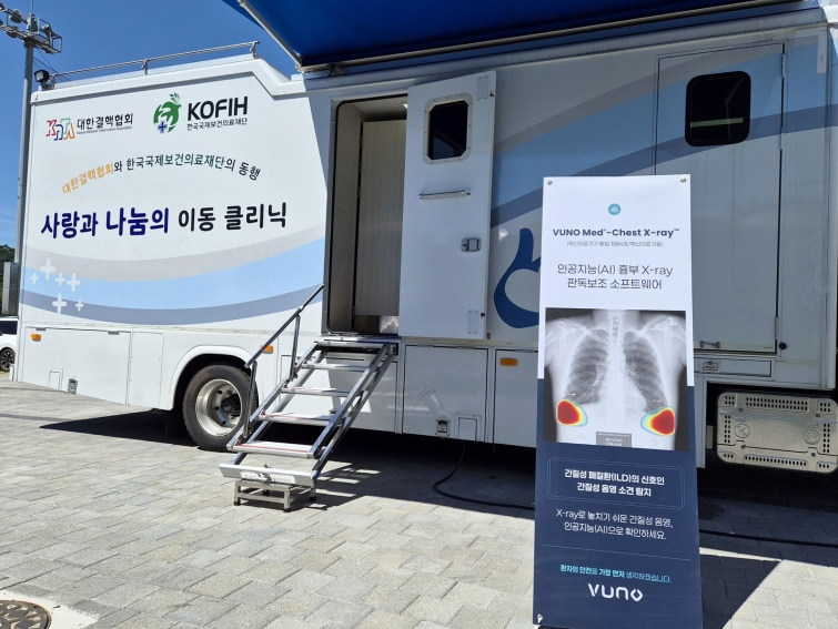 [사진1] 뷰노의 AI 솔루션이 지원된 어르신 대상 폐 건강 검진 버스.jpg